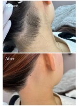 ホワイトワックス 京都四条烏丸(WHITE WAX)/うなじワックス