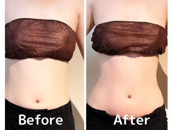 美活ラボ(美活LABO)/ビフォーアフター