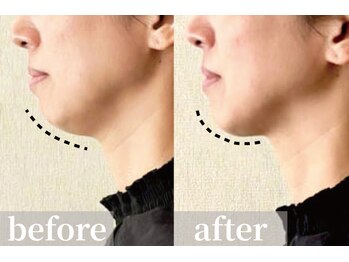 VS28スキンケアスタジオ バリイン 札幌駅前(BALI IN)