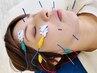 【超・超極上セット4回券】美容鍼（イオン付き）＋パルス(電気)＋お顔＆頭皮