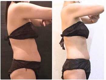 美容整体ウェリナ あま甚目寺院/小顔矯正/骨盤矯正/美脚サロン