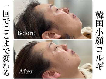 リベルキョウト 京都駅前店(Liber Kyoto)/韓国小顔コルギ