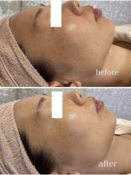 ジェイ(J)/ララピール＋水玉リフティング☆