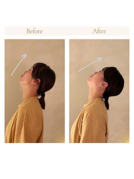 ミマノ 調布(MimanoChofu)/ビフォー&アフター