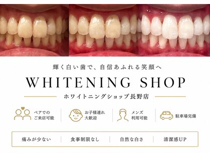 ホワイトニングショップ 長野店の写真