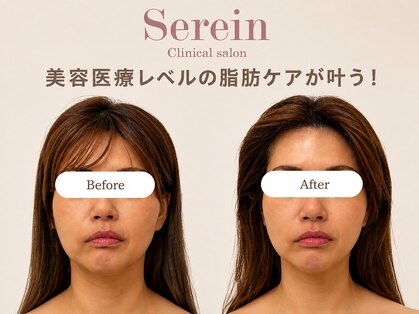 スレーン 上本町(Serein)の写真
