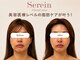 スレーン 上本町(Serein)の写真
