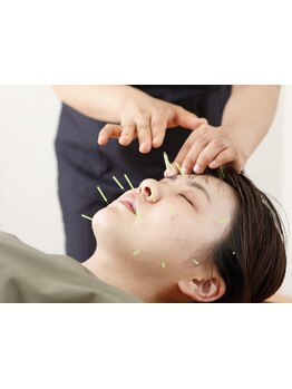 鍼灸施術を受けたい