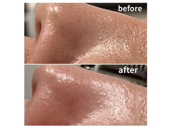 メローワックス 松本駅前店(MELLOW WAX)/メディアクアプロbefore after