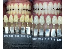 トウキョウスワーズ 池袋店(TOKYO SWRS)/#ホワイトニング #池袋 #渋谷