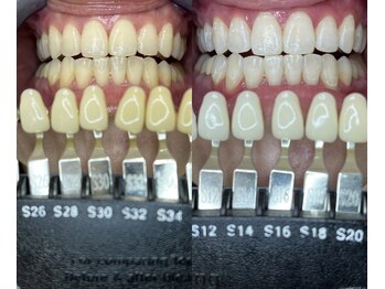 トウキョウスワーズ 池袋店(TOKYO SWRS)/#ホワイトニング #池袋 #渋谷