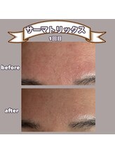 ビーマジック(美magic)/サーマトリックス