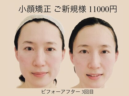 エスツリービューティーアンドネイル(S-TREE BEAUTY&NAIL)の写真