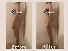 レモン(Lemon)/ビフォーアフター