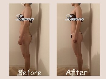 レモン(Lemon)/ビフォーアフター