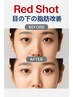 【眼窩脂肪改善×むくみ改善】REDショット・アイゾーンケア+顔スッキリ7900円