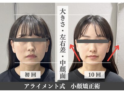 アライメント 自由が丘(Alignment)の写真