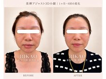 ビカオ(BIKAO)の雰囲気（リアボーテ商品のみの購入もOK/小顔/毛穴/ハーブピーリング）