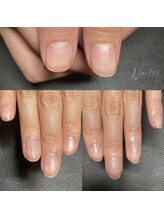 ネイルゴーゴー(NAIL55)/ネイルケアafter2