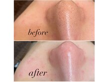 東京都口コミNo,1 エクストラクションをお探しの方は当店へ★