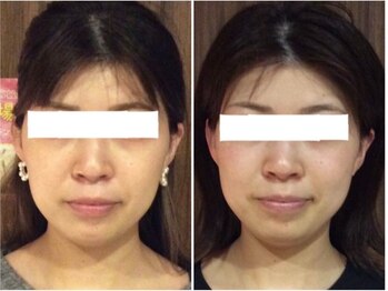 美容整体ウェリナ あま甚目寺院/小顔矯正/骨盤矯正/美脚サロン