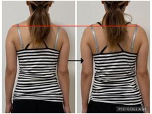 ソリ(soli)/before→after写真