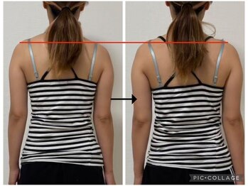 ソリ(soli)/before→after写真