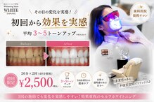 ホワイト 上乃木南店(WHITE)