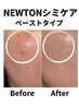 【一度で大変化!!最強シミケア】15分ケア放題！気になるシミを集中狙いうち!!