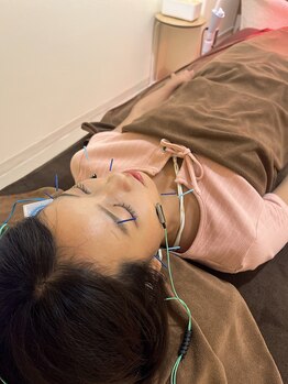 ハリファ鍼灸院 福岡博多院(HariFa鍼灸院)/美容鍼