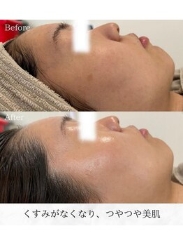 シロ(silo)/つやつや韓国美肌