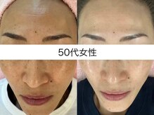 サクラ 本厚木駅前店(SAKURA)/本厚木シミケア/伊勢店シミケア