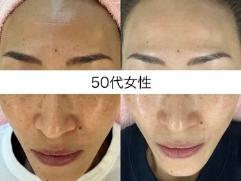 サクラ 本厚木駅前店(SAKURA)/本厚木シミケア/伊勢店シミケア