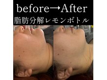 トイボックス(ToyBox.eyelash)の雰囲気（【県内希少!】韓国発塗る脂肪分解レモンボトル導入店♪）