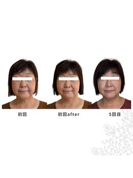 チェリッシュ(Cherish)/