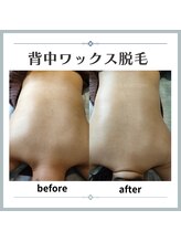 ビー ファクトリー(B FACTORY)/背中ワックス