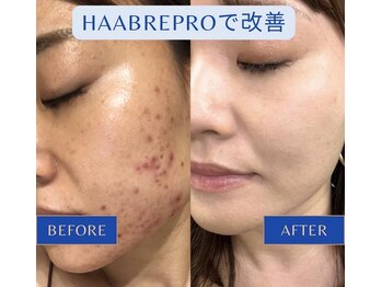 ベルシャトン(Belle Chaton)/