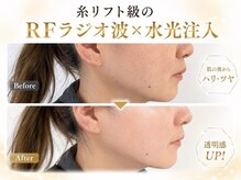 アイムエステ 熊本店(i'm este)の雰囲気（感動の口コミ多数 [毛穴洗浄/小顔/フェイシャル/水光/シミ/熊本]）