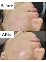 ブラックボックス(BLACK BOX)/30代女性のお客様