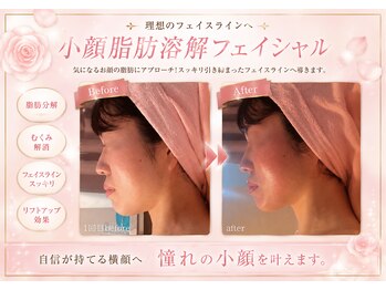 エステティックサロン フェアリー(ESTHETIC SALON FAIRLY)/小顔フェイシャル