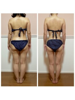 トータル フィルシャイン(Total Fillshine)/痩身モニター様☆★