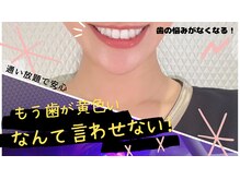 フィフティース(FIFTEETH)