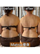 サロンデイジー(Salon Daisy)/Matrix痩身★施術一回