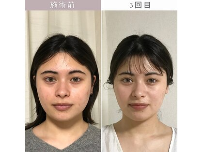 マルヒアの写真