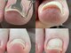 オレンジスティックの写真/巻き気味でフットネイルを躊躇されている方におすすめ★足元からおしゃれを楽しみましょう♪