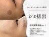 【２回目以降】シミケア10分集中当て放題　6950円