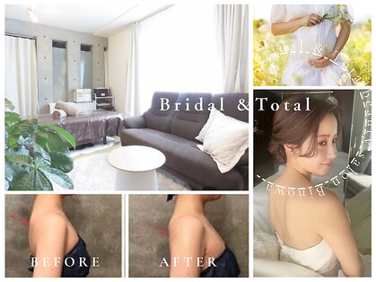 ビノワ(Binowa)の写真