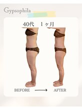 ジプソフィラ(Gypsophila)/痩身ビフォーアフター