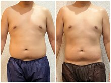 美容整体ウェリナ あま甚目寺院/小顔矯正/骨盤矯正/美脚サロン