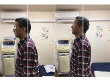 大砂土治療院/肩こり姿勢改善に鍼灸マッサージ